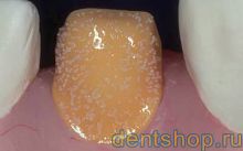 Solidex ������������ ����� 15 ��