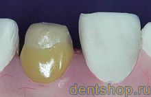 Solidex NCC ���������� ����� 4 ��